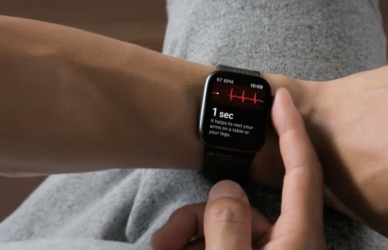 Apple Watch shouing ECG